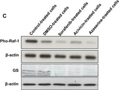 Fig.5.C showing Western Blotting in a Homo sapiens (Human) sample from the publication: Effective Targeting of Glutamine Synthetase with Amino Acid Analogs as a Novel Therapeutic Approach in Breast Cancer.