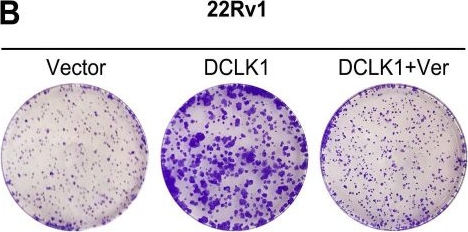 Fig.4.B showing Immunohistochemistry in a Homo sapiens (Human) sample from the publication: Doublecortin-like kinase 1 promotes stem cell-like properties through the Hippo-YAP pathway in prostate cancer.