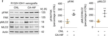 Fig.4.F showing Western Blotting from the publication: Tissue mechanics promote IDH1-dependent HIF1α-tenascin C feedback to regulate glioblastoma aggression.