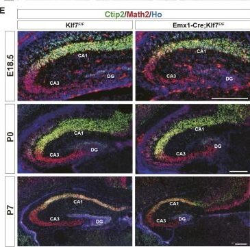 Fig.1.E showing Immunohistochemistry-immunofluorescence from the publication: KLF7 orchestrates hippocampal development through neurogenesis and Draxin-mediated neuronal migration.