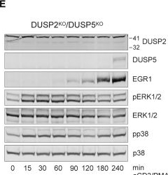 Fig.5.E showing Western Blotting from the publication: The dual specificity phosphatase 2 act as distal regulatory node in T cell signaling.