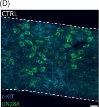Fig.5.D showing Immunohistochemistry-immunofluorescence from the publication: Imatinib decreases germ cell survival and germline stem cell proliferation in rodent testis ex vivo and in vitro.