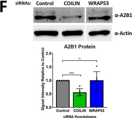 Fig.2.F showing Western Blotting in a Homo sapiens (Human) sample from the publication: Coilin mediates m6A RNA methylation through phosphorylation of METTL3.