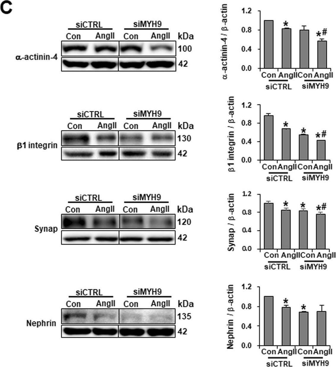 Angiotensin II-mediated MYH9 downregulation causes structural and functional podocyte injury in diabetic kidney disease.
