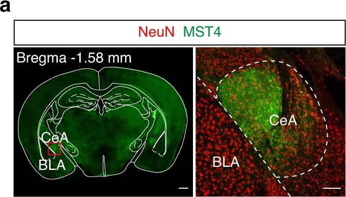 Fig.5.A showing Immunohistochemistry-immunofluorescence in a Mus musculus (House mouse) sample from the publication: Microglia govern the extinction of acute stress-induced anxiety-like behaviors in male mice.