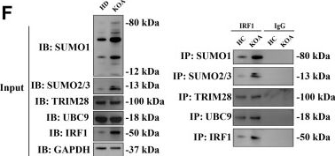 Fig.6.F showing Western Blotting in a Homo sapiens (Human) sample from the publication: High Mobility Group Protein B1 Promotes Interferon Regulatory Factor 1 SUMOylation to Prime Trained Immunity of Circulating Monocytes and Aggravate the Progressive Synovial Inflammation in Knee Osteoarthritis.