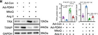 Fig.7.H showing Western Blotting from the publication: PDK4 drives abdominal aortic aneurysm by promoting smooth muscle cell metabolic reprogramming and NLRP3-mediated pyroptosis.