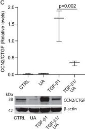 Fig.2.C showing Western Blotting from the publication: Ursolic Acid Inhibits Collagen Production and Promotes Collagen Degradation in Skin Dermal Fibroblasts: Potential Antifibrotic Effects.
