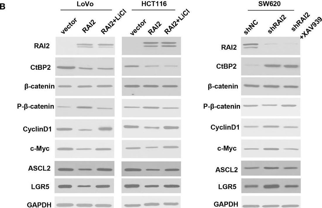 Fig.2.B showing Western Blotting in a Homo sapiens (Human) sample from the publication: Retinoic Acid-Induced 2 (RAI2) Is a Novel Antagonist of Wnt/β-Catenin Signaling Pathway and Potential Biomarker of Chemosensitivity in Colorectal Cancer.