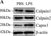 Fig.4.A showing Western Blotting in a Mus musculus (House mouse) sample from the publication: ACSL4 inhibition prevents macrophage ferroptosis and alleviates fibrosis in bleomycin-induced systemic sclerosis model.