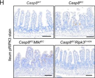 Fig.5.H showing Immunohistochemistry in a Mus musculus (House mouse) sample from the publication: The kinase domain of RIPK3 tunes its scaffolding functions.