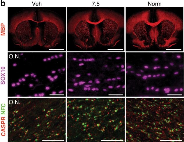 Fig.5.B showing Immunohistochemistry-immunofluorescence in a Mus musculus (House mouse) sample from the publication: Minimum effective dose of clemastine in a mouse model of preterm white matter injury.