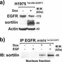 Fig.8.A showing Western Blotting from the publication: Sortilin exhibits tumor suppressor-like activity by limiting EGFR transduction function.
