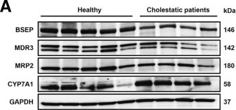 Fig.10.A showing Western Blotting in a Homo sapiens (Human) sample from the publication: Differential Protective Roles of c-Jun N-terminal Kinase-2 in Nonparenchymal Liver Cells and Hepatocytes During Cholestasis.