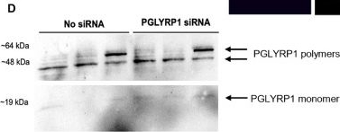Fig.3.D showing Western Blotting from the publication: The bovine mammosphere-derived epithelial cell secretome inhibits bacterial growth in vitro and contains peptidoglycan recognition protein 1.