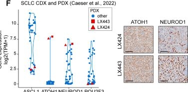 Fig.1.F showing Immunohistochemistry from the publication: Functional characterization of the ATOH1 molecular subtype indicates a pro-metastatic role in small cell lung cancer.