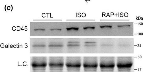Fig.2.C showing Western Blotting in a Rattus norvegicus (Rat) sample from the publication: mTORC1 hyperactivation and resultant suppression of macroautophagy contribute to the induction of cardiomyocyte necroptosis by catecholamine surges.
