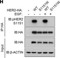 Fig.2.H showing Western Blotting from the publication: HER2 deficiency causes a developmental disorder with growth retardation and craniofacial malformations.