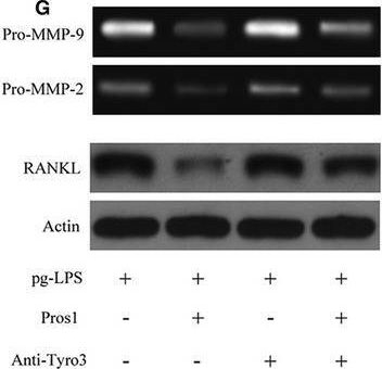 Fig.4.G showing Western Blotting from the publication: The Pros1/Tyro3 axis protects against periodontitis by modulating STAT/SOCS signalling.