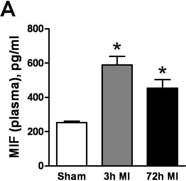 Fig.3.A showing Enzyme-linked immunosorbent assay from the publication: Pro-inflammatory action of MIF in acute myocardial infarction via activation of peripheral blood mononuclear cells.