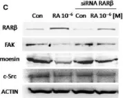 Fig.4.C showing Western Blotting in a Homo sapiens (Human) sample from the publication: Retinoic acid reduces migration of human breast cancer cells: role of retinoic acid receptor beta.