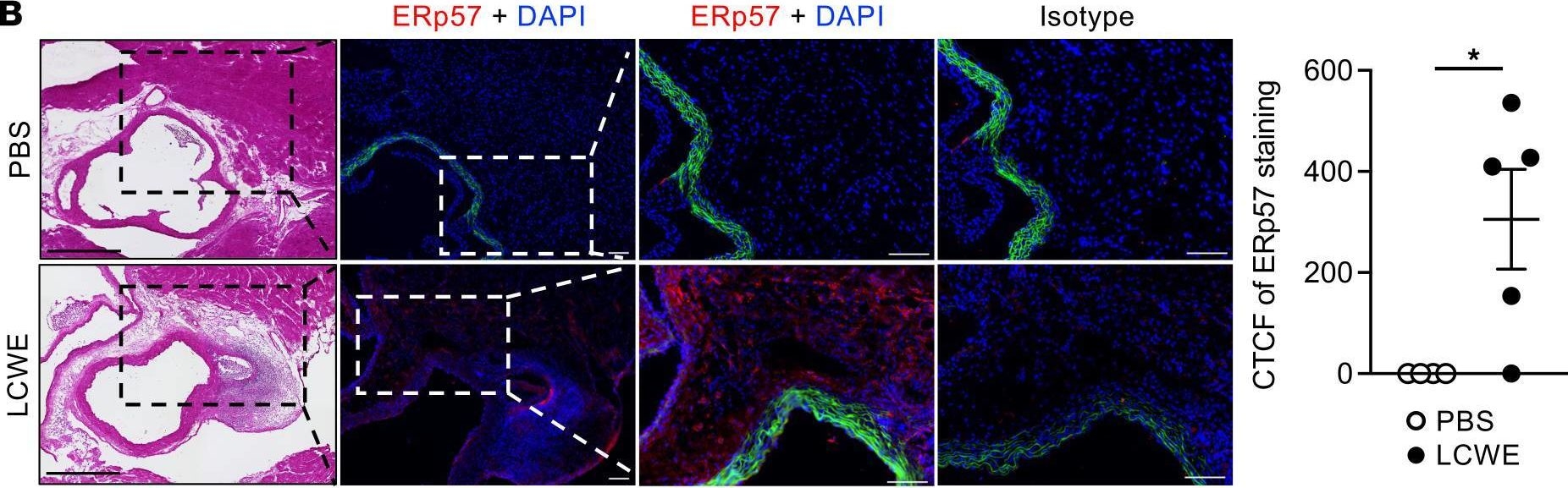 Fig.4.B showing Immunohistochemistry-immunofluorescence in a Mus musculus (House mouse) sample from the publication: Targeting IRE1 endoribonuclease activity alleviates cardiovascular lesions in a murine model of Kawasaki disease vasculitis.
