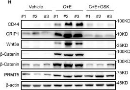 Fig.7.H showing Western Blotting from the publication: PRMT1/PRMT5-Mediated Differential Arginine Methylation of CRIP1 Promotes the Recurrence of Small Cell Lung Cancer after Chemotherapy.