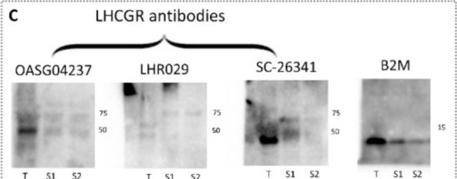 Fig.1.C showing Western Blotting from the publication: Possible Relevance of Soluble Luteinizing Hormone Receptor during Development and Adulthood in Boys and Men.