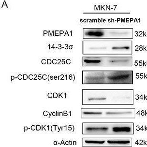 Fig.5.A showing Western Blotting in a Homo sapiens (Human) sample from the publication: PMEPA1 promotes gastric cancer cell proliferation by regulating the ubiquitin-mediated degradation of 14-3-3σ and promoting cell cycle progression.