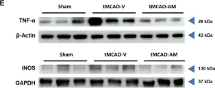 Fig.4.E showing Western Blotting from the publication: Neuroprotective Efficacy of Astragalus mongholicus in Ischemic Stroke: Antioxidant and Anti-Inflammatory Mechanisms.