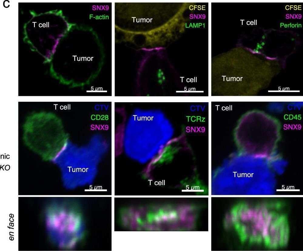 Fig.3.C showing Immunocytochemistry-immunofluorescence from the publication: Deletion of SNX9 alleviates CD8 T cell exhaustion for effective cellular cancer immunotherapy.