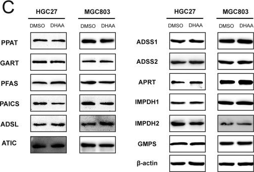 Fig.4.C showing Western Blotting from the publication: Dehydroabietylamine exerts antitumor effects by affecting nucleotide metabolism in gastric cancer.