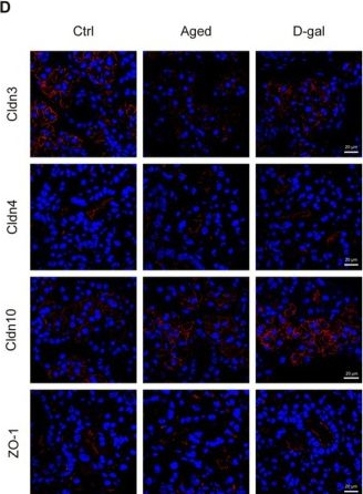 Fig.3.D showing Immunocytochemistry-immunofluorescence in a Mus musculus (House mouse) sample from the publication: Cellular Senescence Contributes to the Dysfunction of Tight Junctions in Submandibular Glands of Aging Mice.