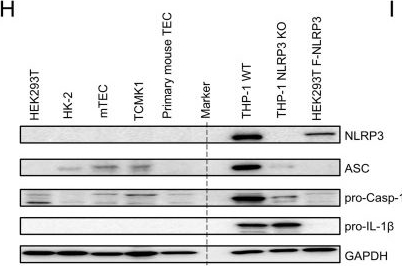 Fig.1.H showing Western Blotting from the publication: Bone Marrow-Derived Macrophage NLRP3 Mediates Renal Fibrosis by triggering TGF-β/Smad3-mediated Macrophage-Myofibroblast Transition.
