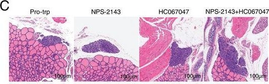 Fig.7.C showing Immunohistochemistry from the publication: Lactobacillus johnsonii Generates Cyclo(pro-trp) and Promotes Intestinal Ca2+ Absorption to Alleviate CKD-SHPT.