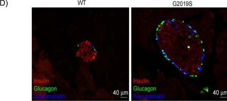 Fig.1.D showing Immunohistochemistry-immunofluorescence in a Mus musculus (House mouse) sample from the publication: LRRK2 kinase modulates glucose-stimulated insulin secretion via RAB8 phosphorylation and ciliogenesis.