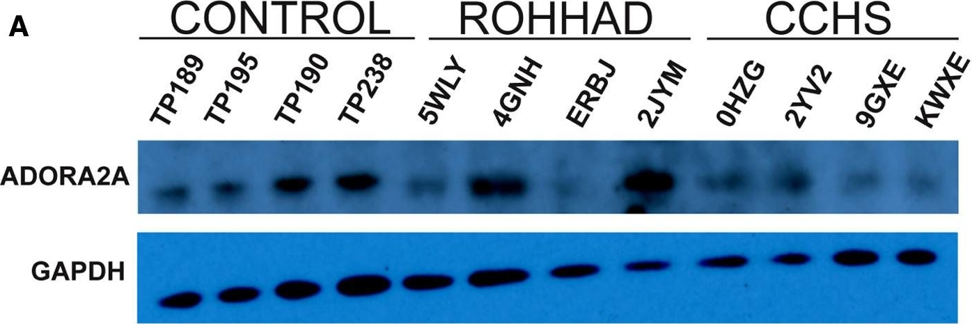 Fig.4.A showing Western Blotting from the publication: Analysis and comparisons of gene expression changes in patient- derived neurons from ROHHAD, CCHS, and PWS.