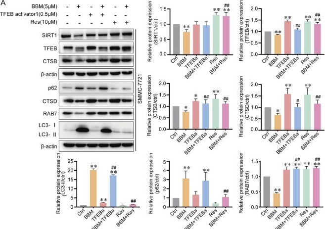 Fig.6.A showing Western Blotting from the publication: Berbamine sensitizes hepatocellular carcinoma to chemotherapy by inhibiting autophagy via modulating SIRT1-mediated acetylation.
