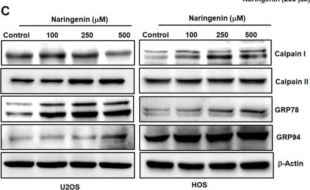 Fig.4.C showing Western Blotting in a Homo sapiens (Human) sample from the publication: Naringenin Induces ROS-Mediated ER Stress, Autophagy, and Apoptosis in Human Osteosarcoma Cell Lines.