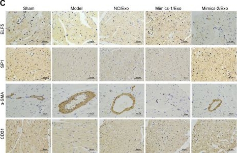Fig.8.C showing Immunohistochemistry in an Armoracia rusticana (Horseradish) sample from the publication: EPC-Derived Exosomal miR-1246 and miR-1290 Regulate Phenotypic Changes of Fibroblasts to Endothelial Cells to Exert Protective Effects on Myocardial Infarction by Targeting ELF5 and SP1.