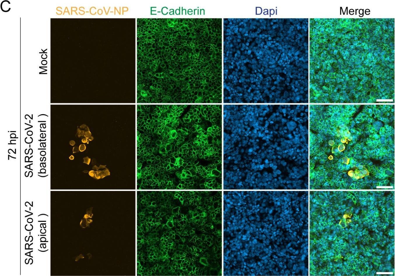 Fig.4.C showing Immunocytochemistry-immunofluorescence in a Homo sapiens (Human) sample from the publication: SARS-CoV-2 infects epithelial cells of the blood-cerebrospinal fluid barrier rather than endothelial cells or pericytes of the blood-brain barrier.