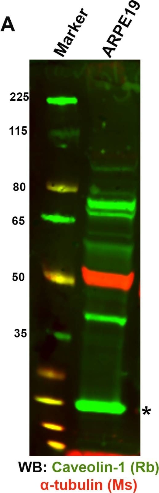 Fig.11.A showing Western Blotting in a Homo sapiens (Human) sample from the publication: Low-Density Lipoprotein Receptor (LDLR) Is Involved in Internalization of Lentiviral Particles Pseudotyped with SARS-CoV-2 Spike Protein in Ocular Cells.