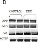 Fig.2.D showing Western Blotting from the publication: Involvement of 5-lipoxygenase in the corticosteroid-dependent amyloid beta formation: in vitro and in vivo evidence.
