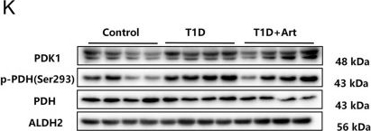 Fig.8.K showing Western Blotting in a Mus musculus (House mouse) sample from the publication: Artemether ameliorates type 1 diabetic liver injury alongside the associated defects in mitochondrial ultrastructure and central carbon metabolism.