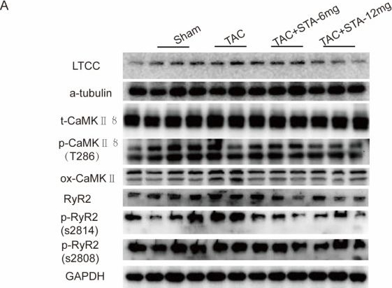 Fig.6.A showing Western Blotting from the publication: Stachydrine Hydrochloride Regulates the NOX2-ROS-Signaling Axis in Pressure-Overload-Induced Heart Failure.