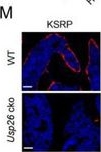 Fig.6.M showing Immunohistochemistry-immunofluorescence from the publication: Activating the Osteoblastic USP26 Pathway Alleviates Multi-Organ Fibrosis by Decreasing Insulin Resistance.