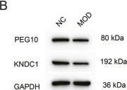 Fig.3.B showing Western Blotting in a Homo sapiens (Human) sample from the publication: miR-379-5p promotes ovarian granulosa cell apoptosis in primary ovarian insufficiency by targeting KNDC1 and PEG10.