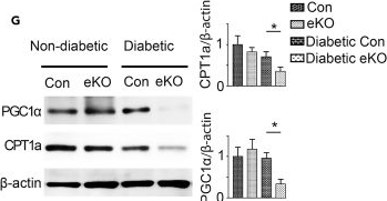 Fig.5.G showing Western Blotting from the publication: Endothelial SIRT3 regulates myofibroblast metabolic shifts in diabetic kidneys.