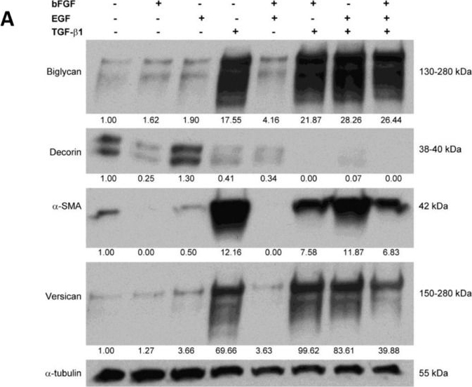 Fig.2.A showing Western Blotting in a Homo sapiens (Human) sample from the publication: Differential regulation of extracellular matrix protein expression in carcinoma-associated fibroblasts by TGF-β1 regulates cancer cell spreading but not adhesion.