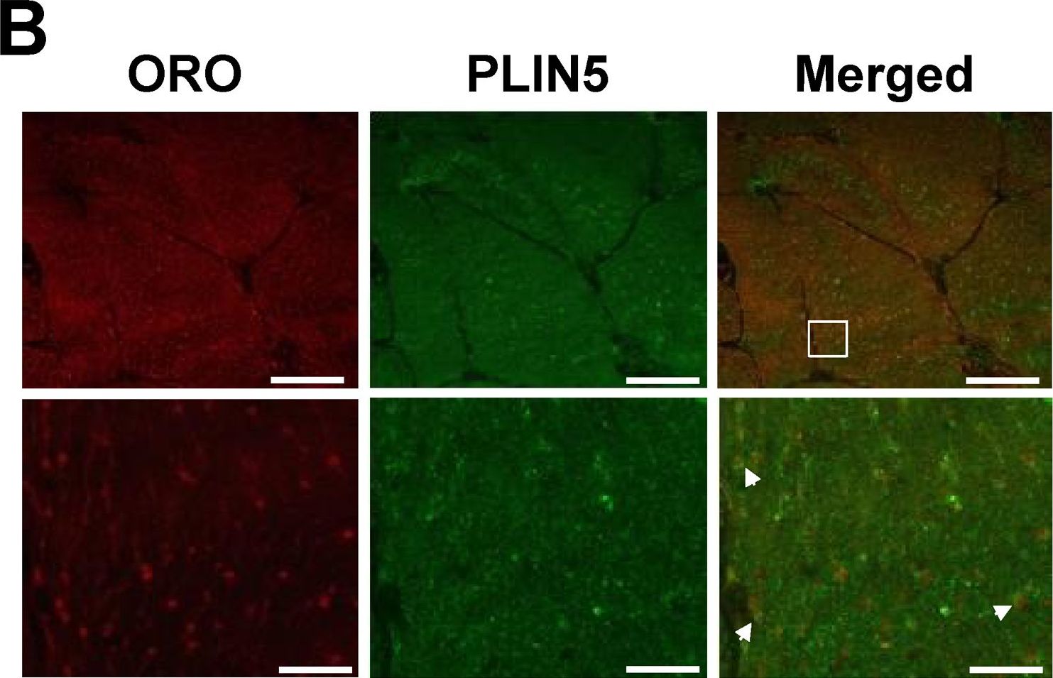 Cellular localization and associations of the major lipolytic proteins in human skeletal muscle at rest and during exercise.